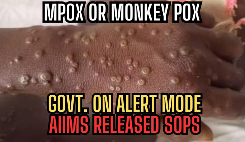 MPox or MonkeyPox